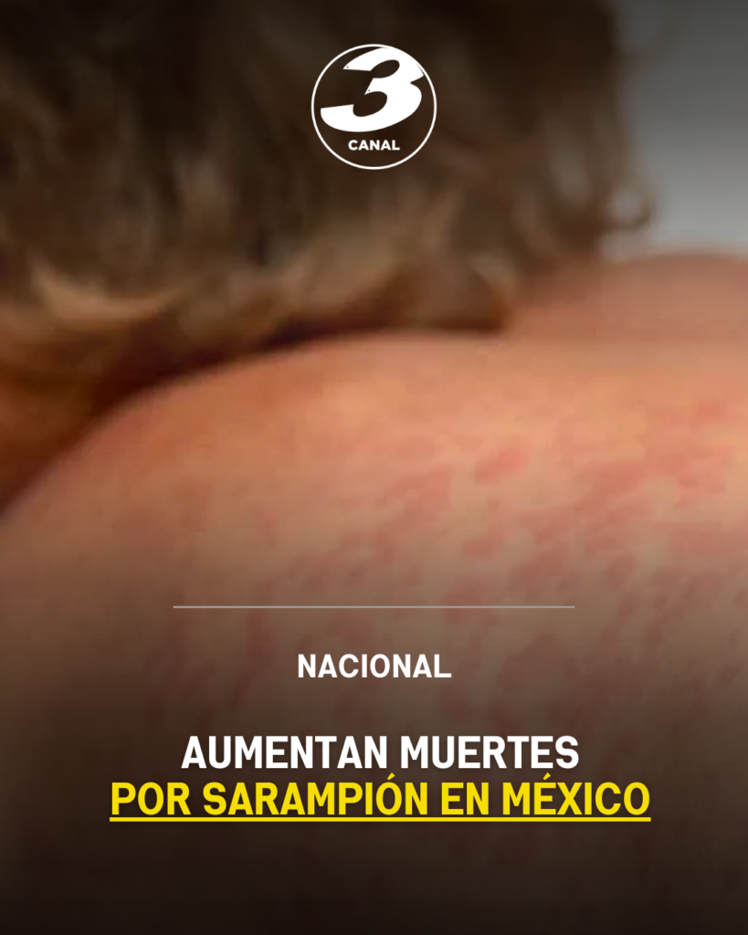Aumentan muertes por sarampión en México