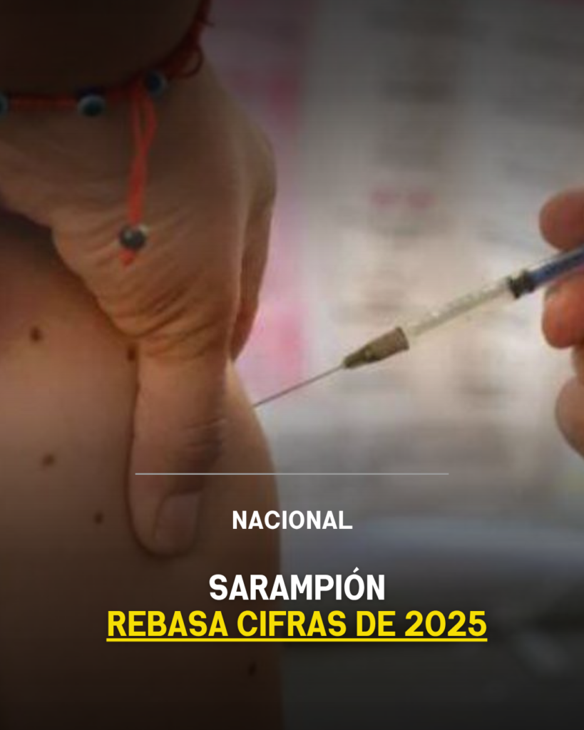 Sarampión rebasa cifras de 2025