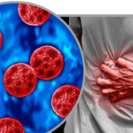 Ciclosporiasis: una infección intestinal que puede afectar seriamente la salud